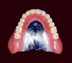 コバルトクロム床義歯
