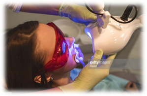 オフィスホワイトニング